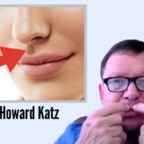 Under-the-Nose Botox Injection (Dr. Howard Katz)