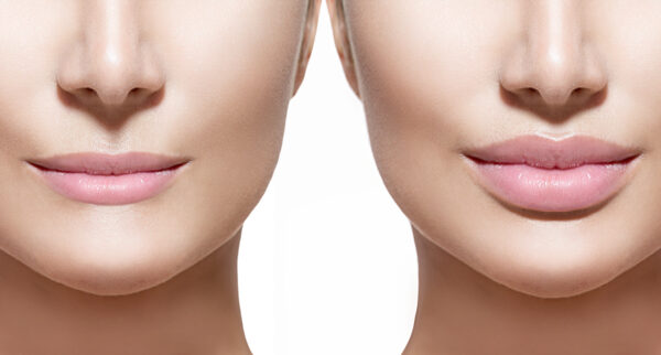 Understanding The Difference Between Botox, Fillers And More