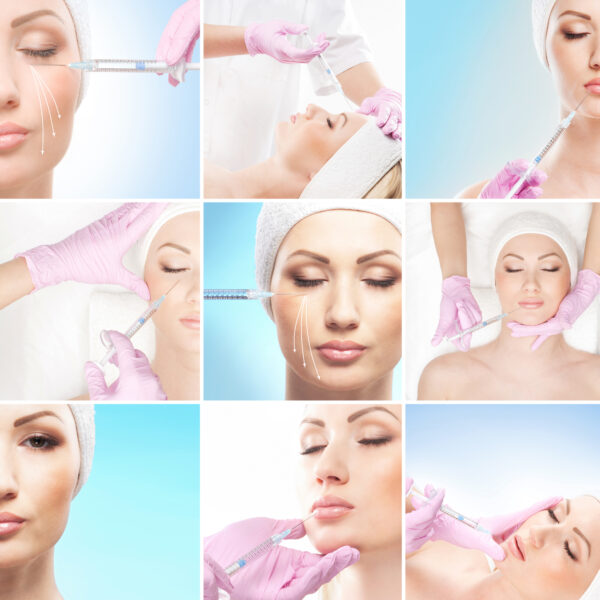 A microneedle will be used to administer Botox to the specific facial muscles that are contributing to wrinkles.
