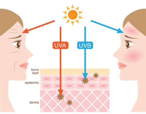 Overexposure to UV radiation, which can cause the skin to sag or stretch, or frequent expressions, which leave lines, can produce crow's feet, frown lines, and wrinkles.