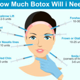 Will One BOTOX Treatment Do The Trick, Or Will I Need More?