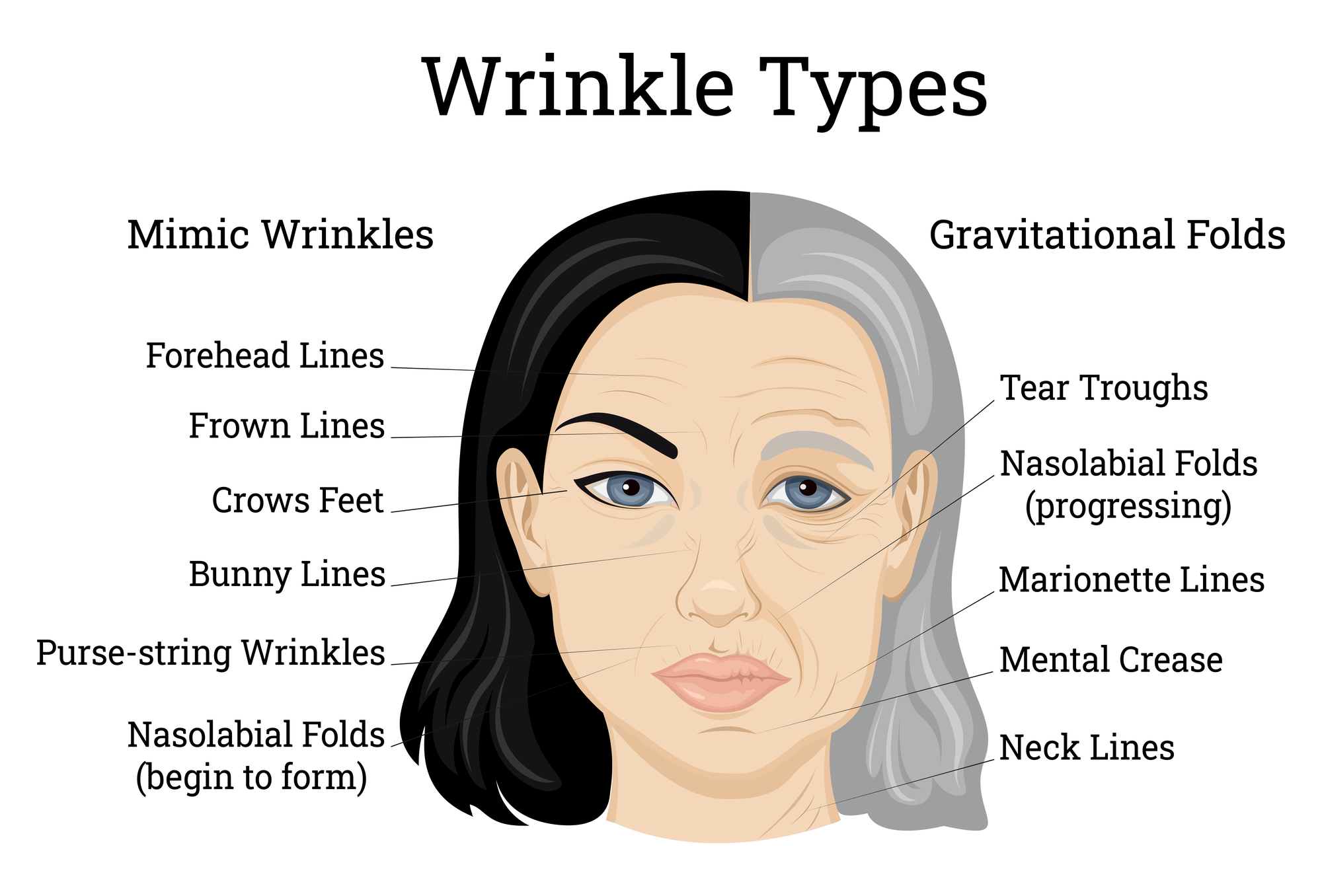 Top tier wrinkle prevention 🫡 . . . . . . #wrinkletreatment  #wrinkleprevention #botoxinjections