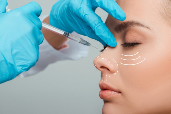 Low-dose Botox injections can relax this muscle and elevate the nose tip back to its "natural" position.