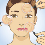 The Effects of Botox on Your Body