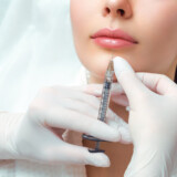 Unveiling the Artistry of Dermal Fillers: Enhancing Lips and Rejuvenating the Face